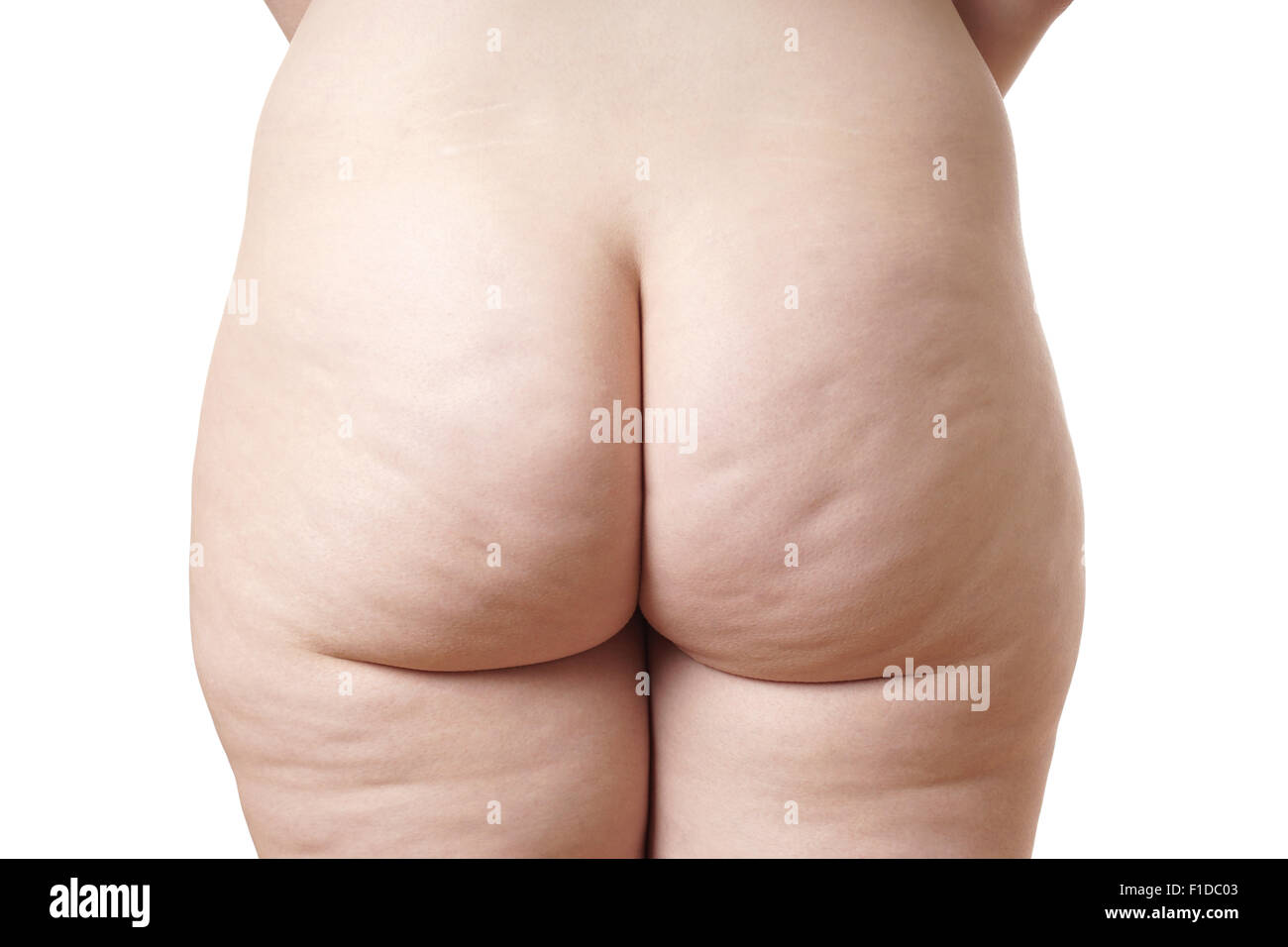 female bottom with cellulite Stock Photo