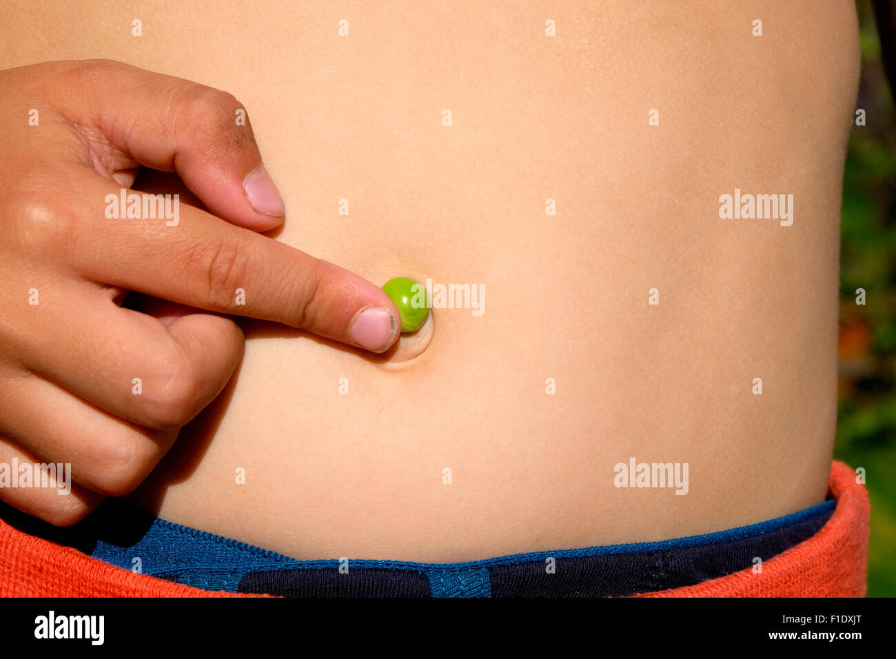 Umbilical hernia in baby hi-res stock photography and images - Alamy