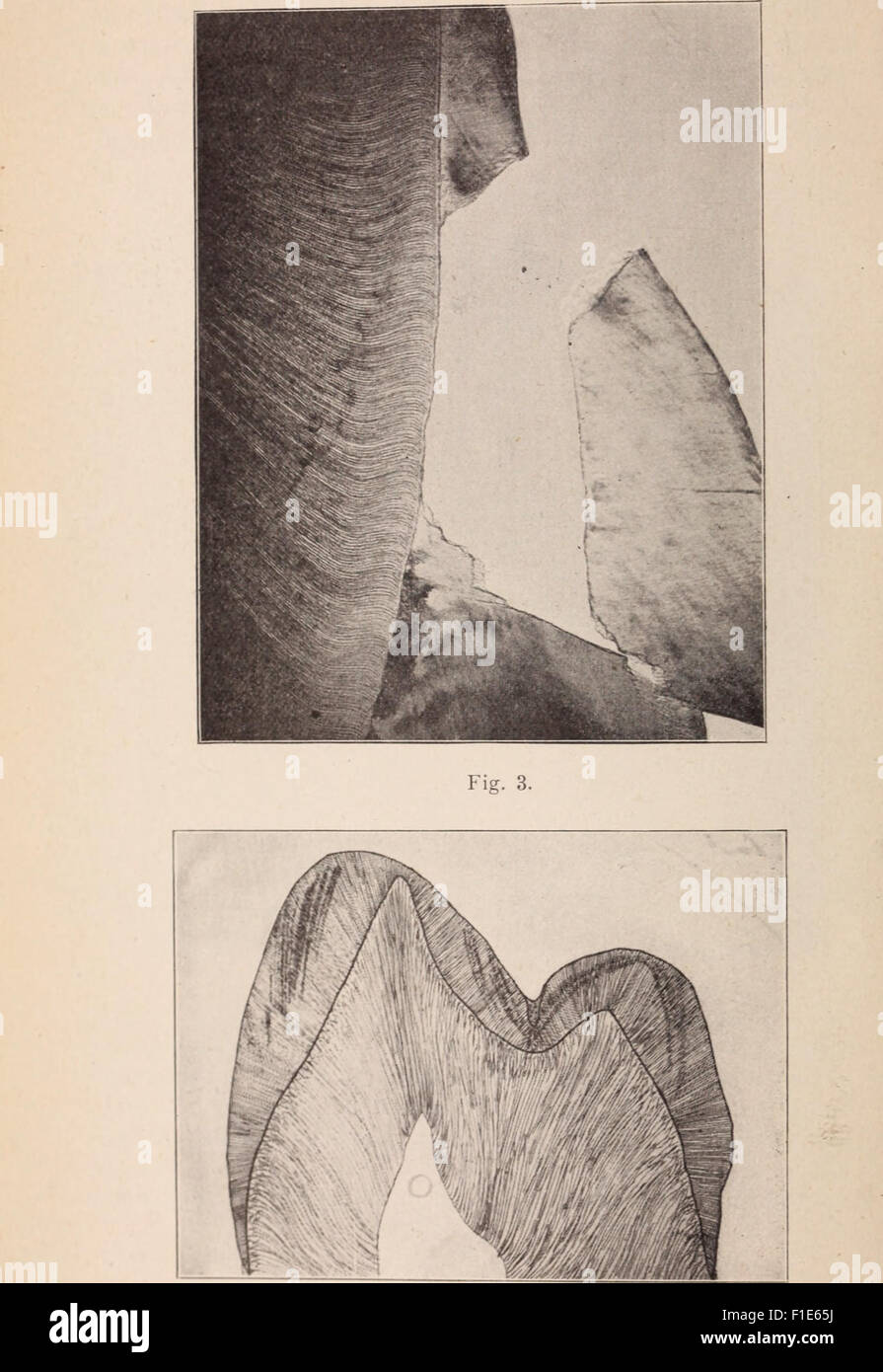 Dental review; devoted to the advancement of dentistry. (1901 Stock