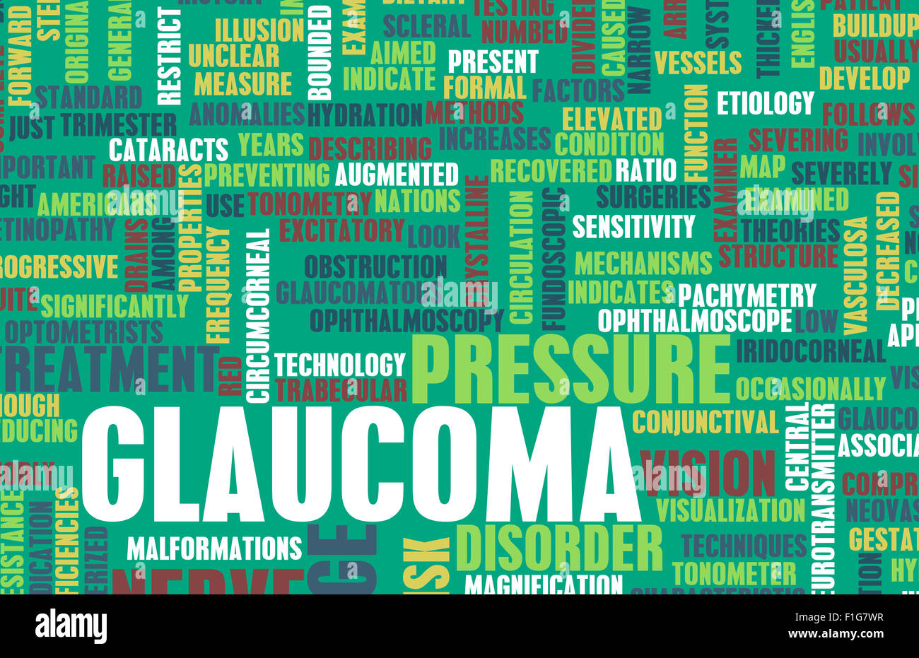 is an Ocular Eye Disorder of the Optic Nerve Stock Photo Alamy