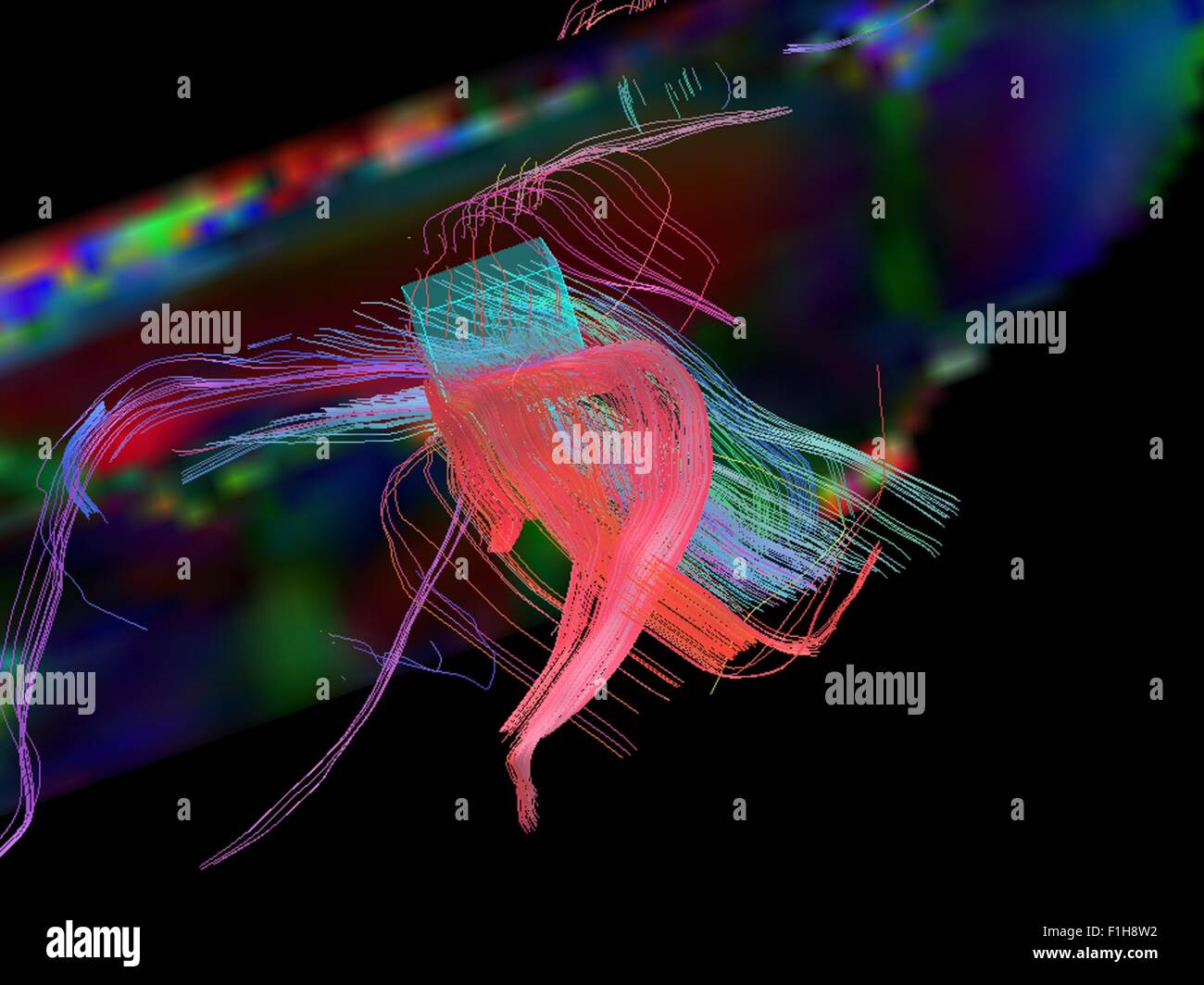 Nerve fibers brain hi-res stock photography and images - Alamy