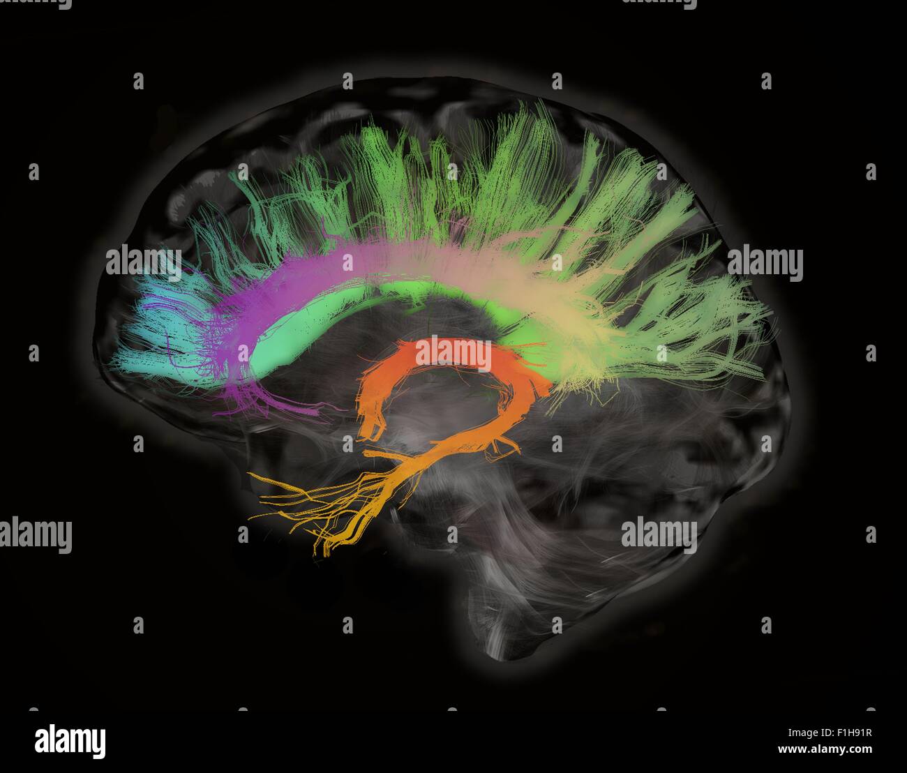 The fiber tracts involved aging. splenium genu corpus callosum fornix cingulum bundle. Human subject Stock Photo