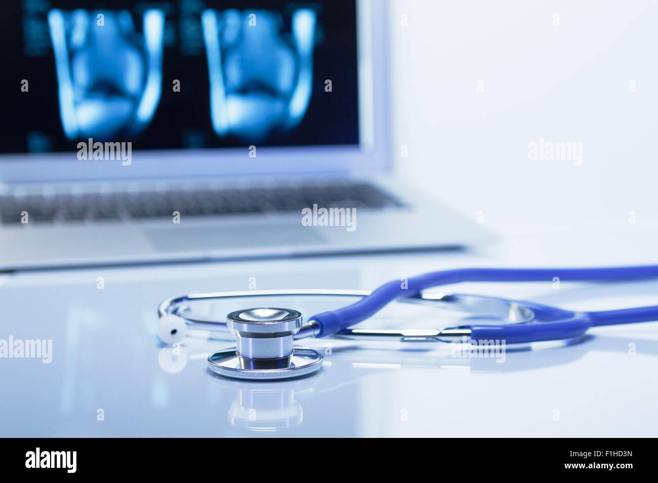 Modern orthopedics. Acoustic stethoscope and a laptop computer displaying MRI images of a knee Stock Photo