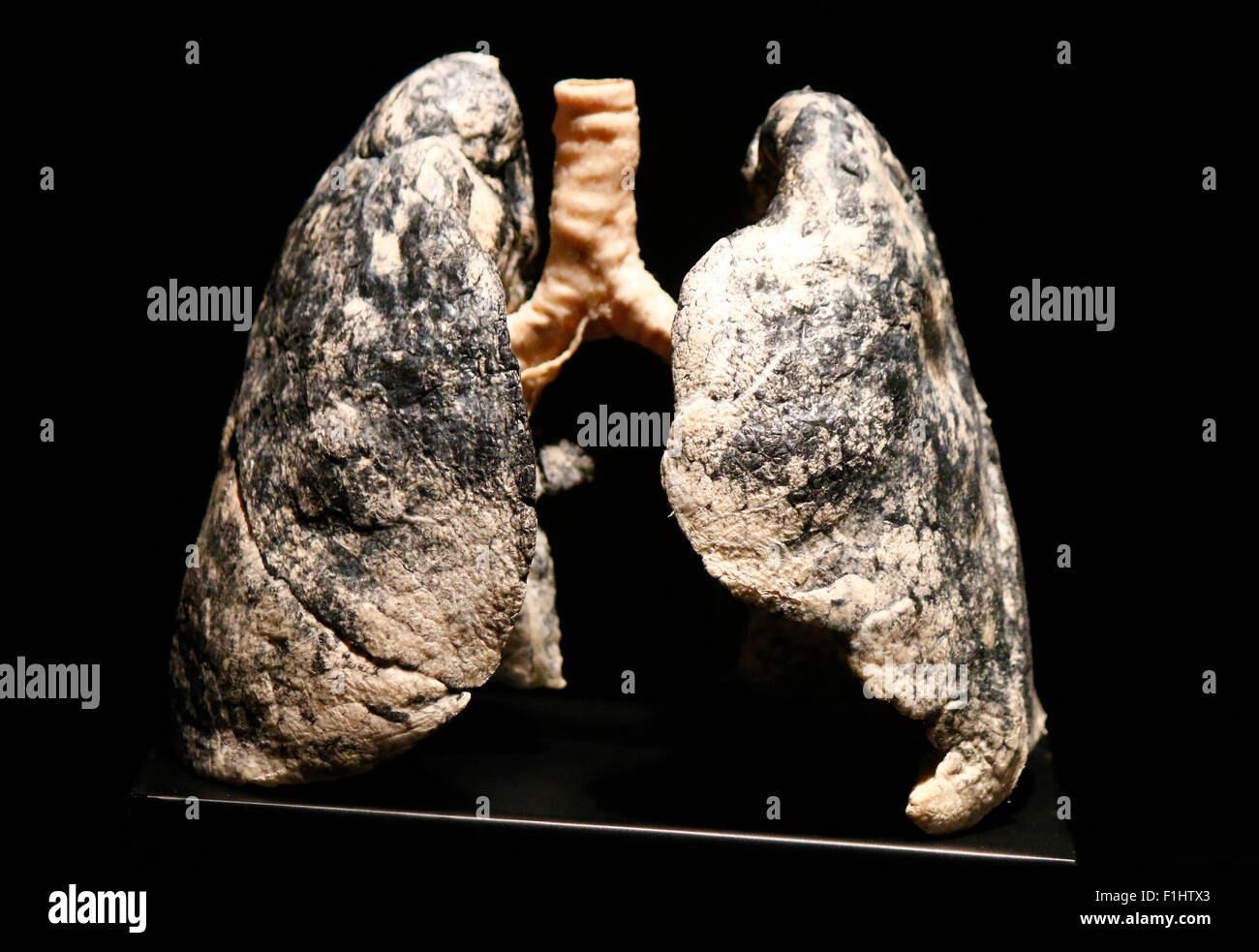 Smokers lung hi-res stock photography and images