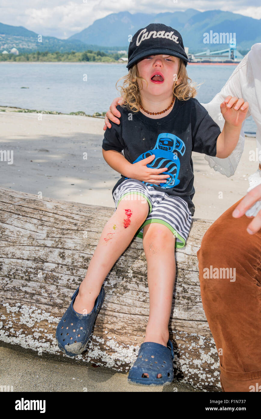 Young boy crying because of bloody cut knee. Stock Photo