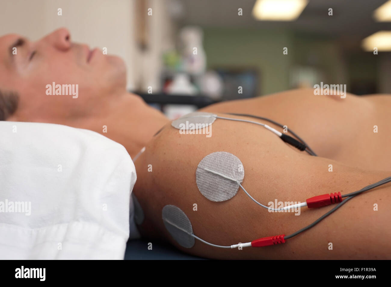 Treatment of a male patient's shoulder using transcutaneous, interferential, electrical stimulation. Stock Photo