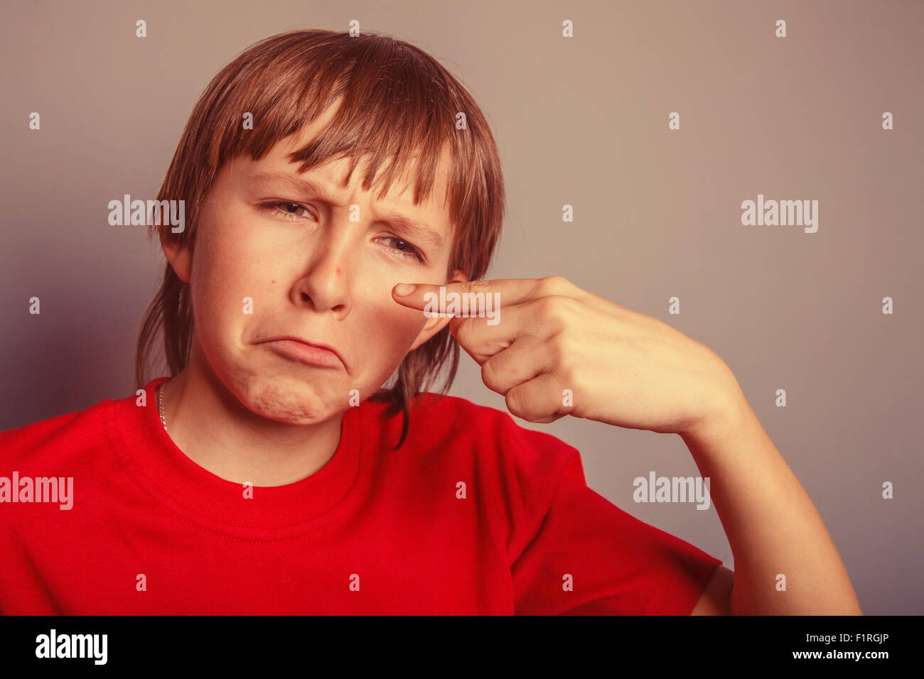 European-looking boy of ten years pimple on the nose, upset over Stock Photo