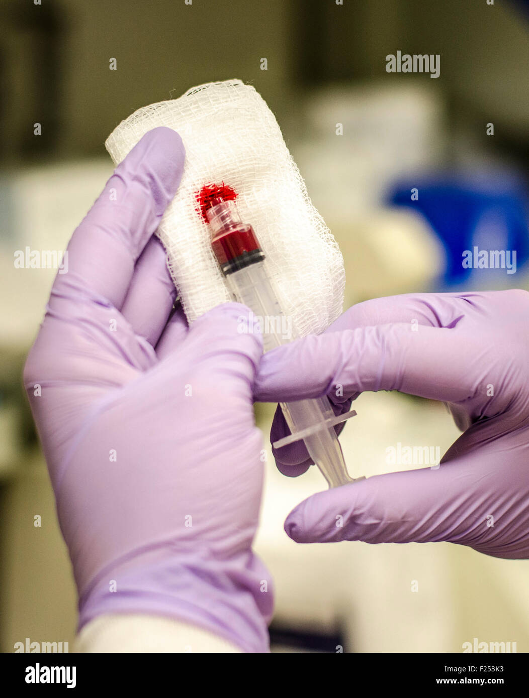 Two gloved hands holding a Medical Blood Gas sample, Checking for clots and removing air bubbles. Stock Photo