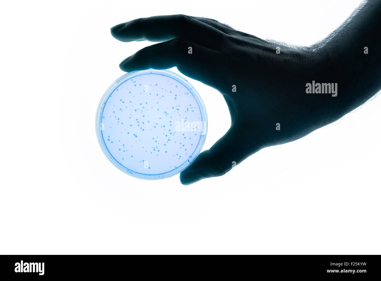 Image of a hand holding a Petri dish Stock Photo Alamy