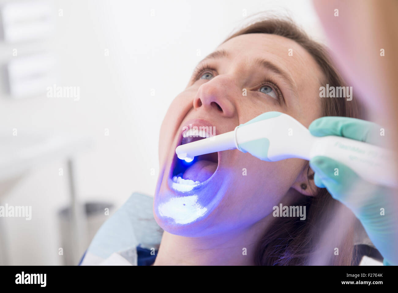 Woman receiving dental filling drying procedure, Munich, Bavaria, Germany Stock Photo