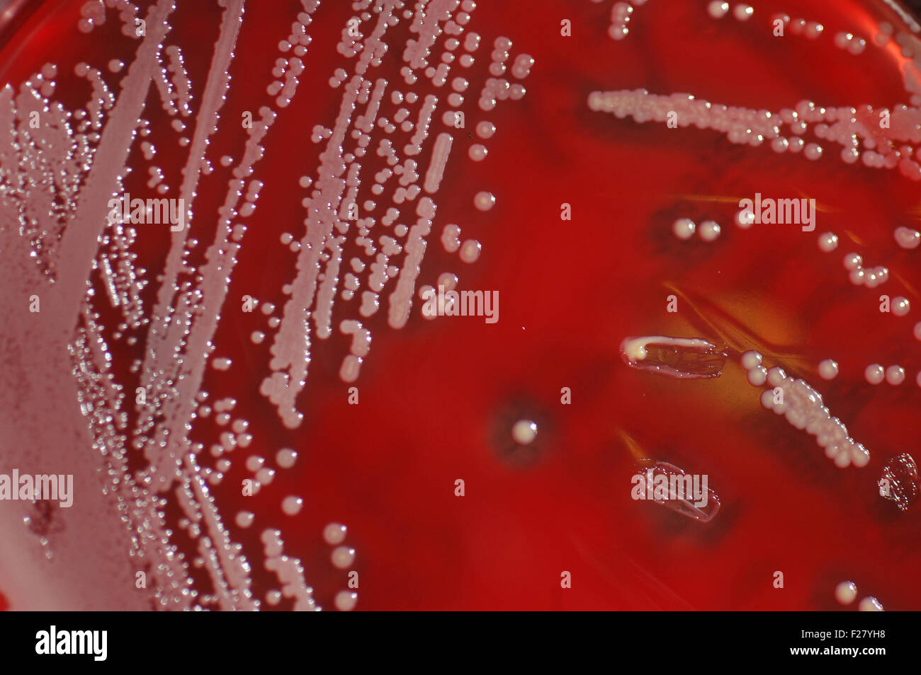 Bacterial colonies growing on culture of sheep's blood Stock Photo