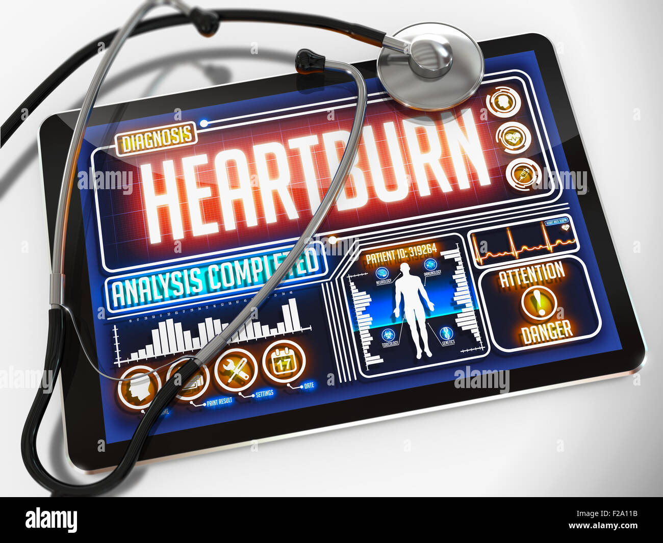 Heartburn on the Display of Medical Tablet. Stock Photo