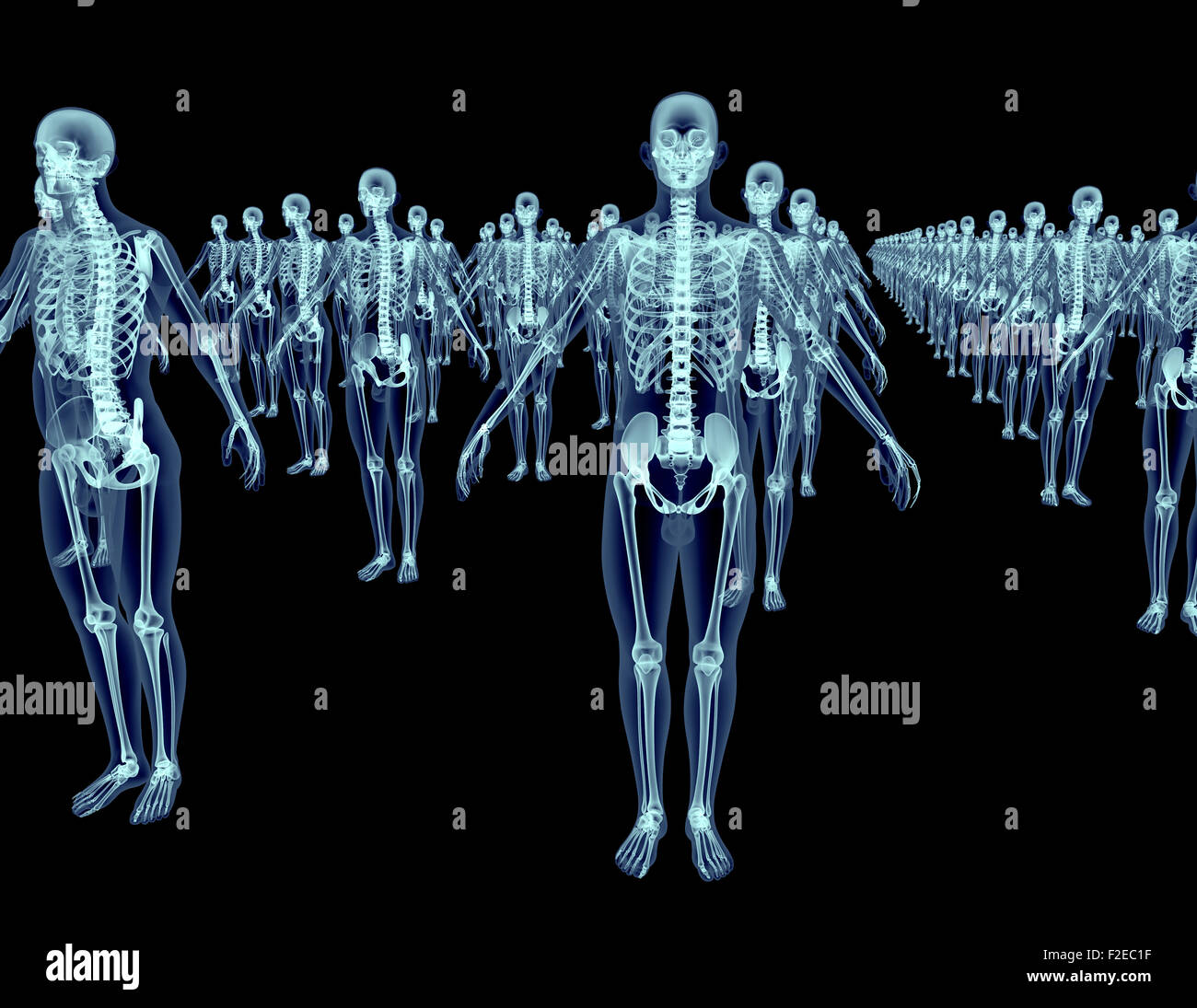 lot of xray skeletons isolated on black Stock Photo