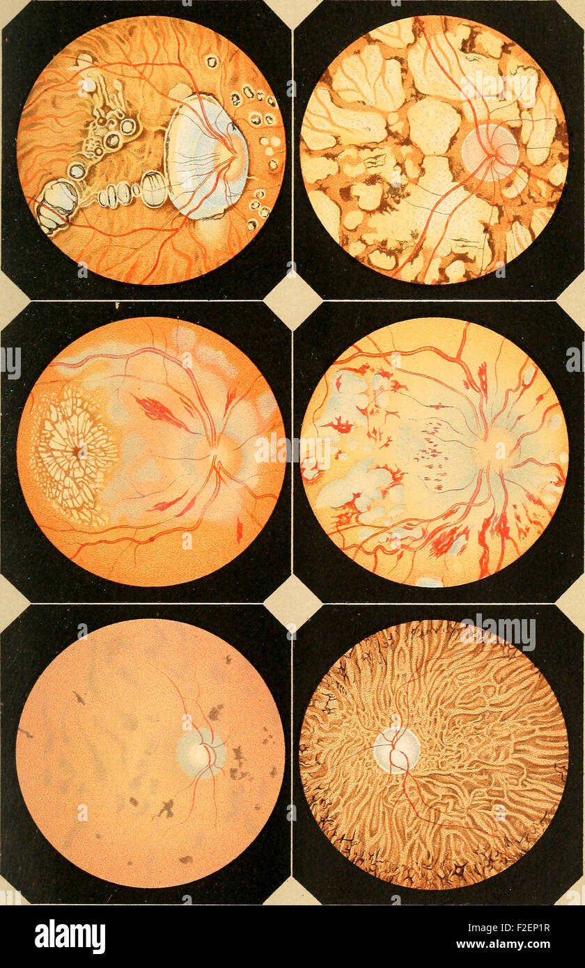 Lehrbuch Der Praktischen Augenheilkunde