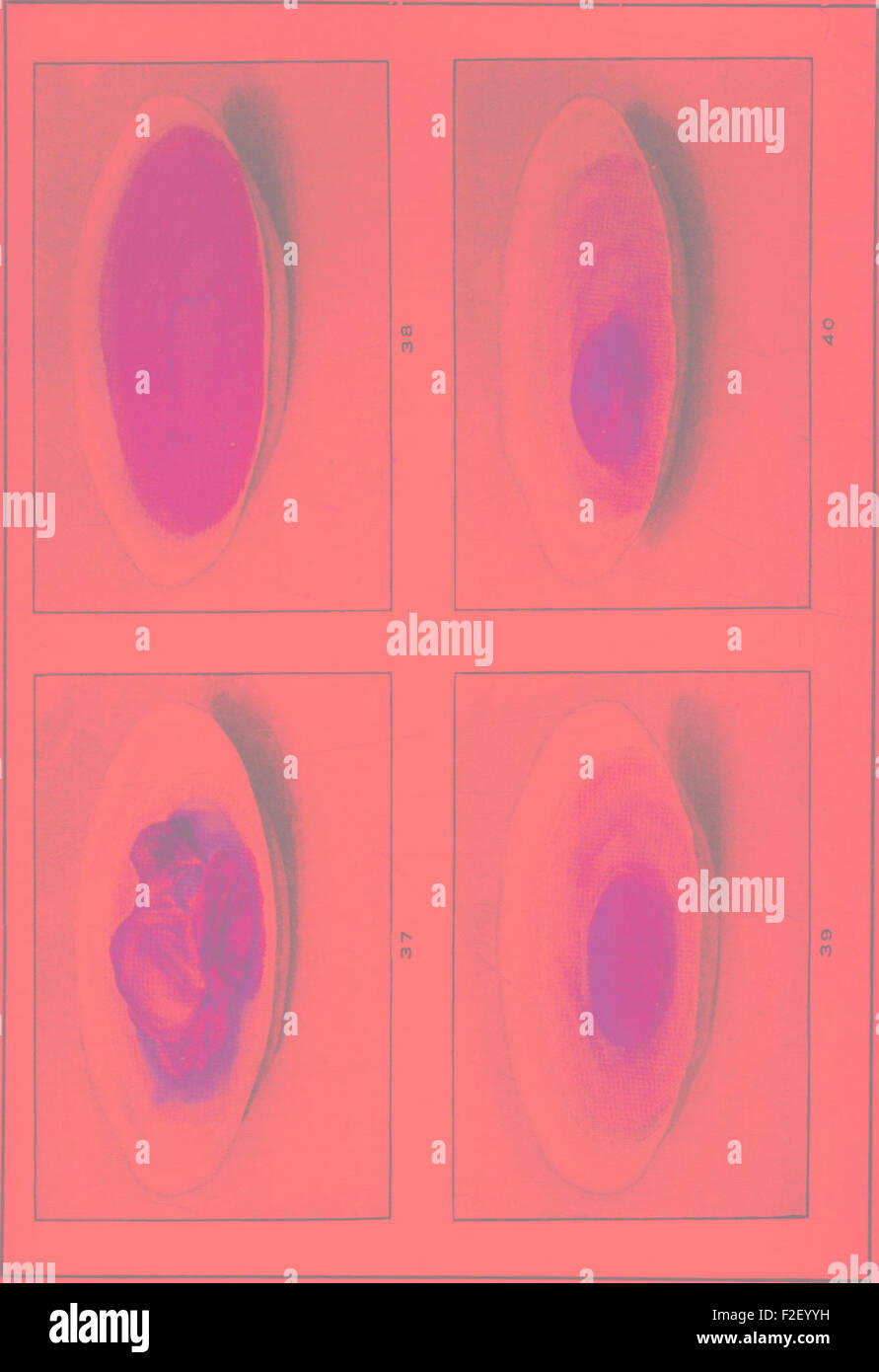 Bacteriology and mycology of foods (1919 Stock Photo Alamy