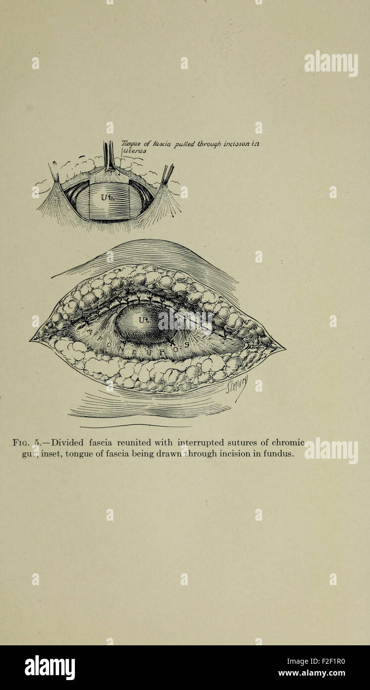 Transaction Surgery The 1920 Transactions of the Southern Surgical and Gynecological ...