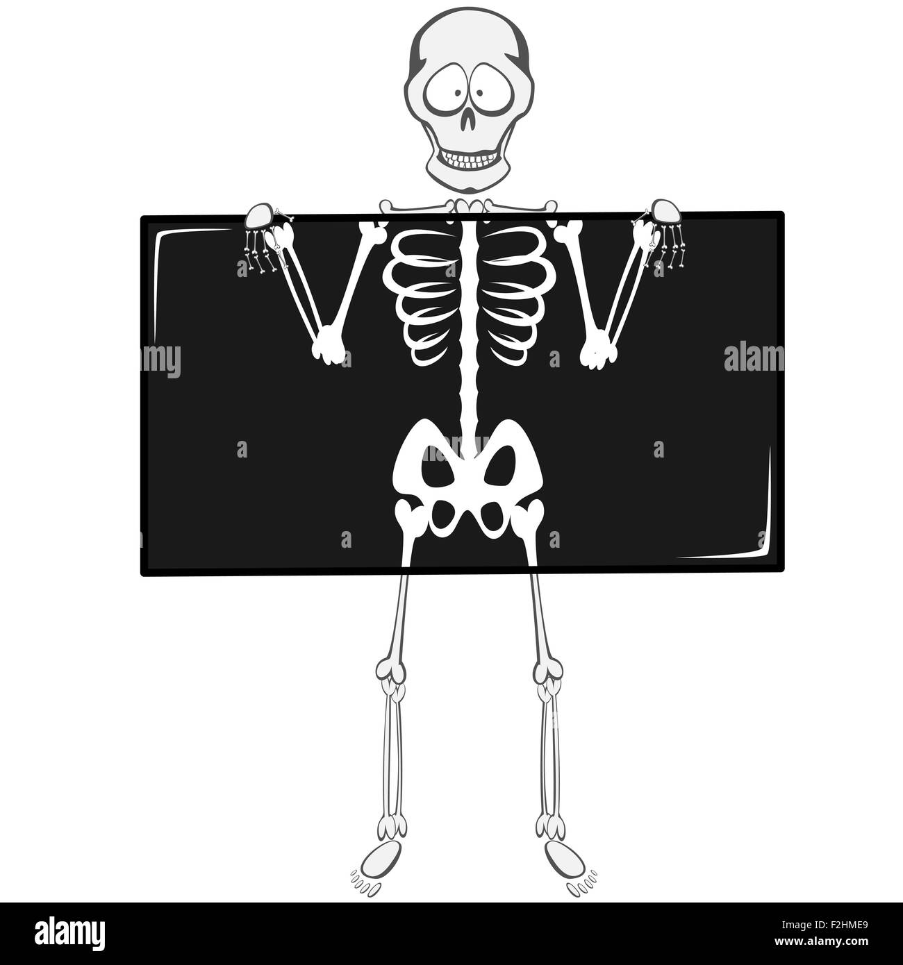 cartoon xray