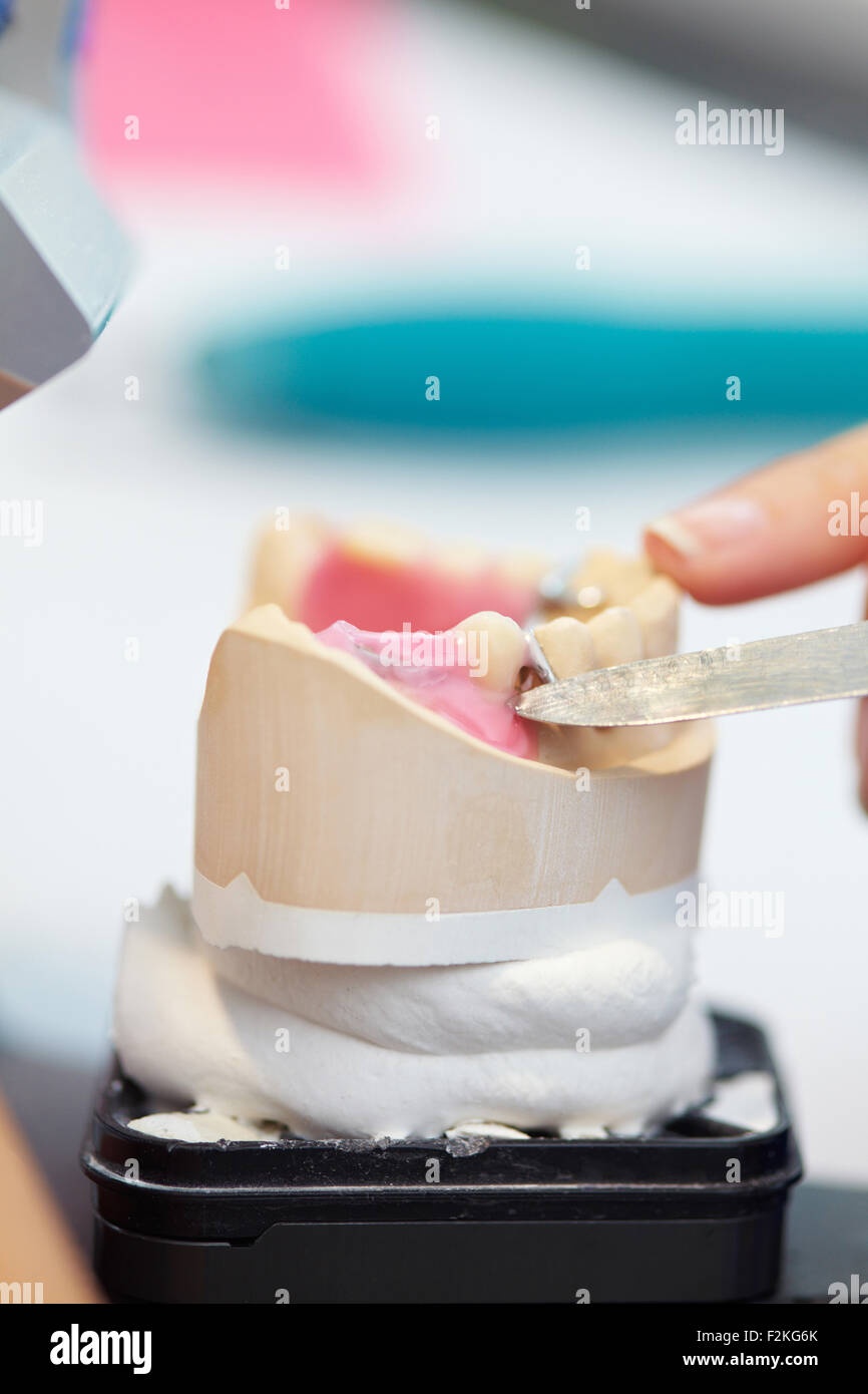 Work on dentures with modeling wax in a dental laboratory Stock Photo