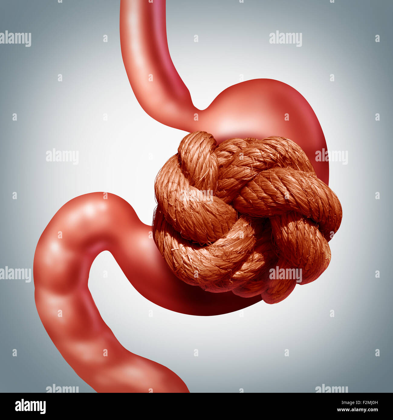 Nervous stomach problem and pain or stomachache and ulcer discomfort concept as a human digestive organ painfully wrapped with a tight rope knot as a medical healthcare stress and anxiety symptoms symbol. Stock Photo