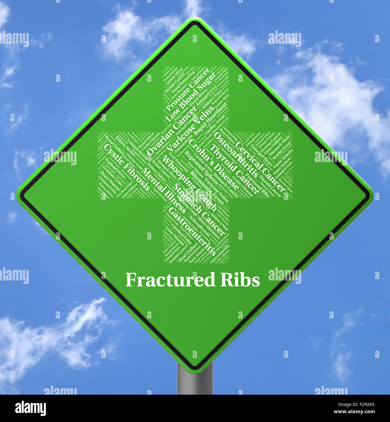 Fractured Ribs Meaning Ill Health And Ailment Stock Photo