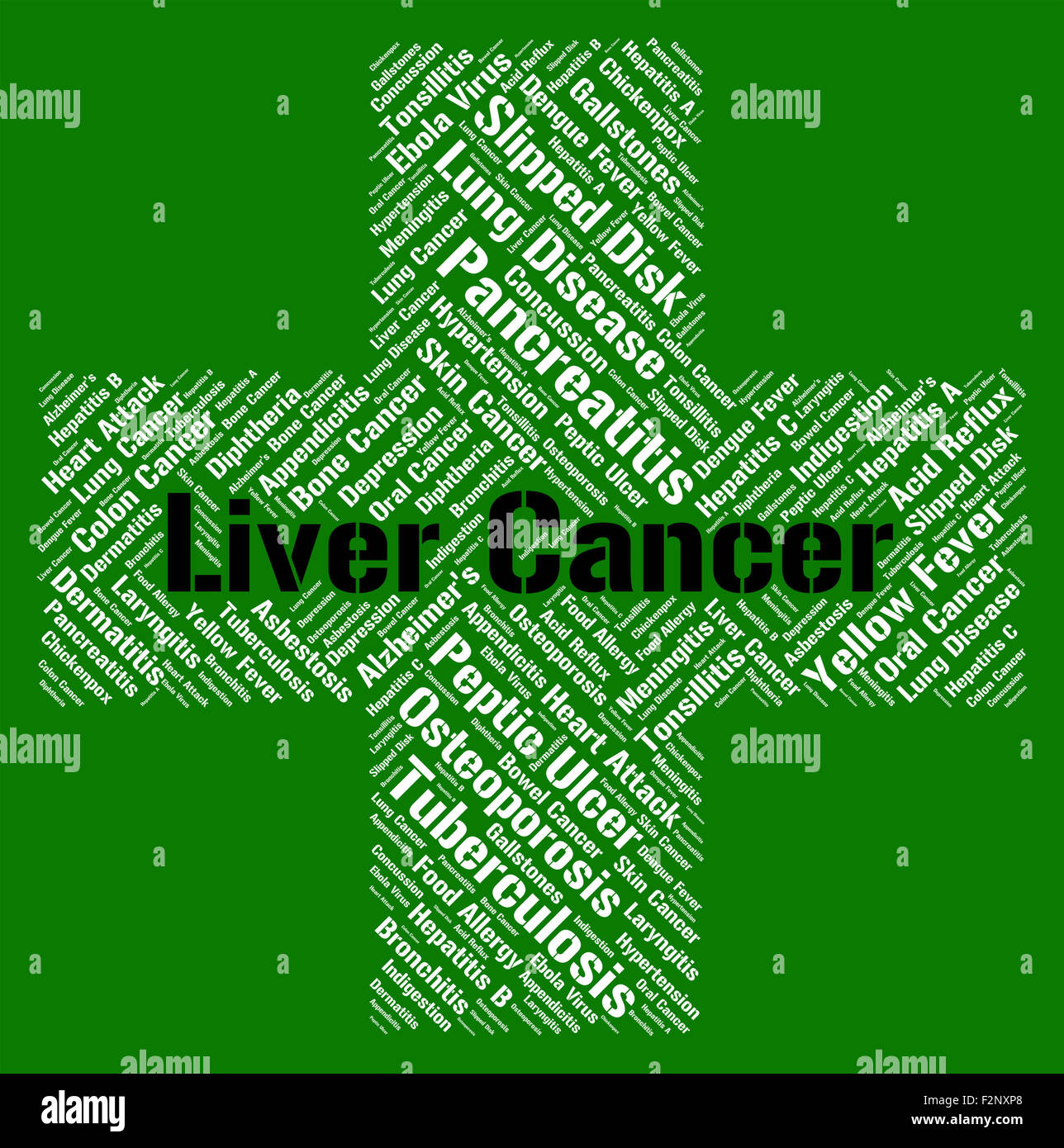 Liver Cancer Showing Malignant Growth And Malignancy Stock Photo