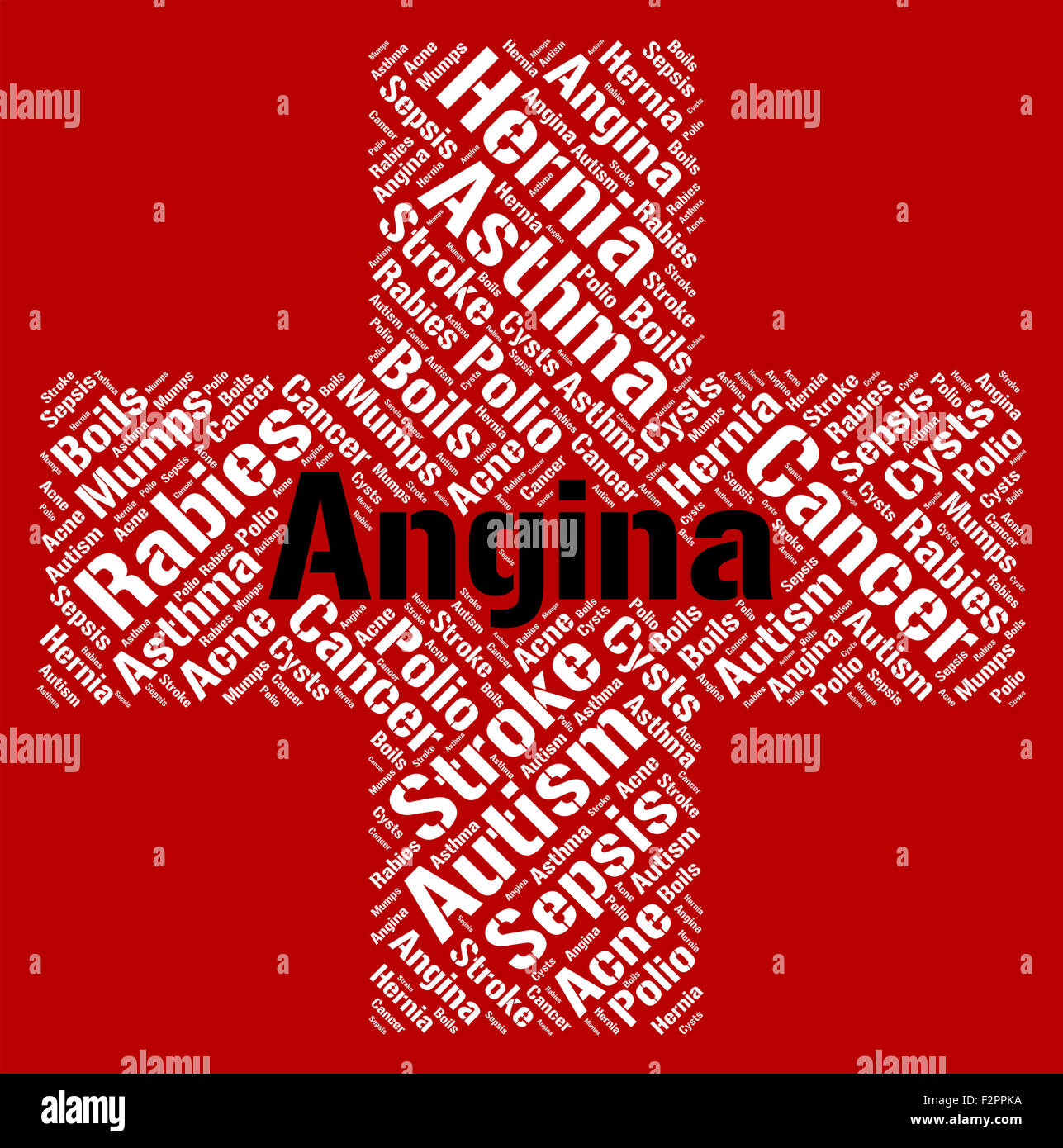Angina Word Showing Congestive Heart Failure And Congenital Heart Disease Stock Photo