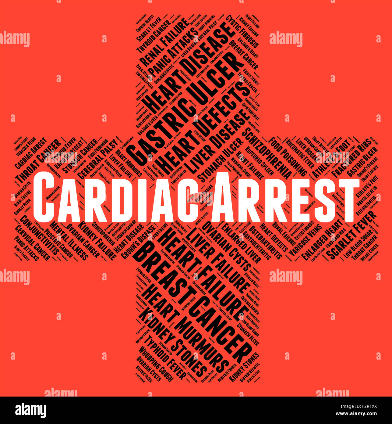 Cardiac Arrest Representing Congestive Heart Failure And Heart