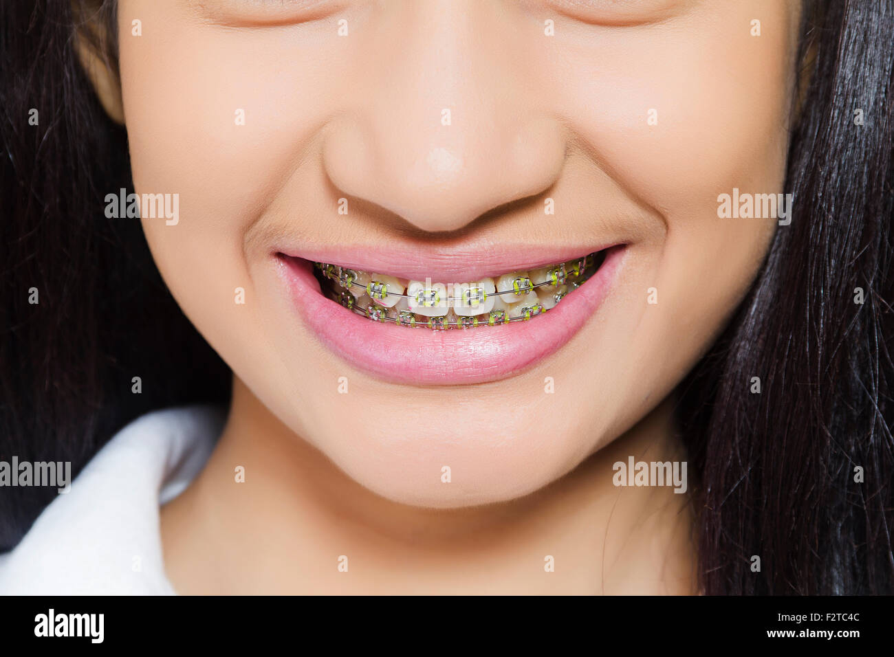 1 indian Teenager Girl Teeth Showing Stock Photo