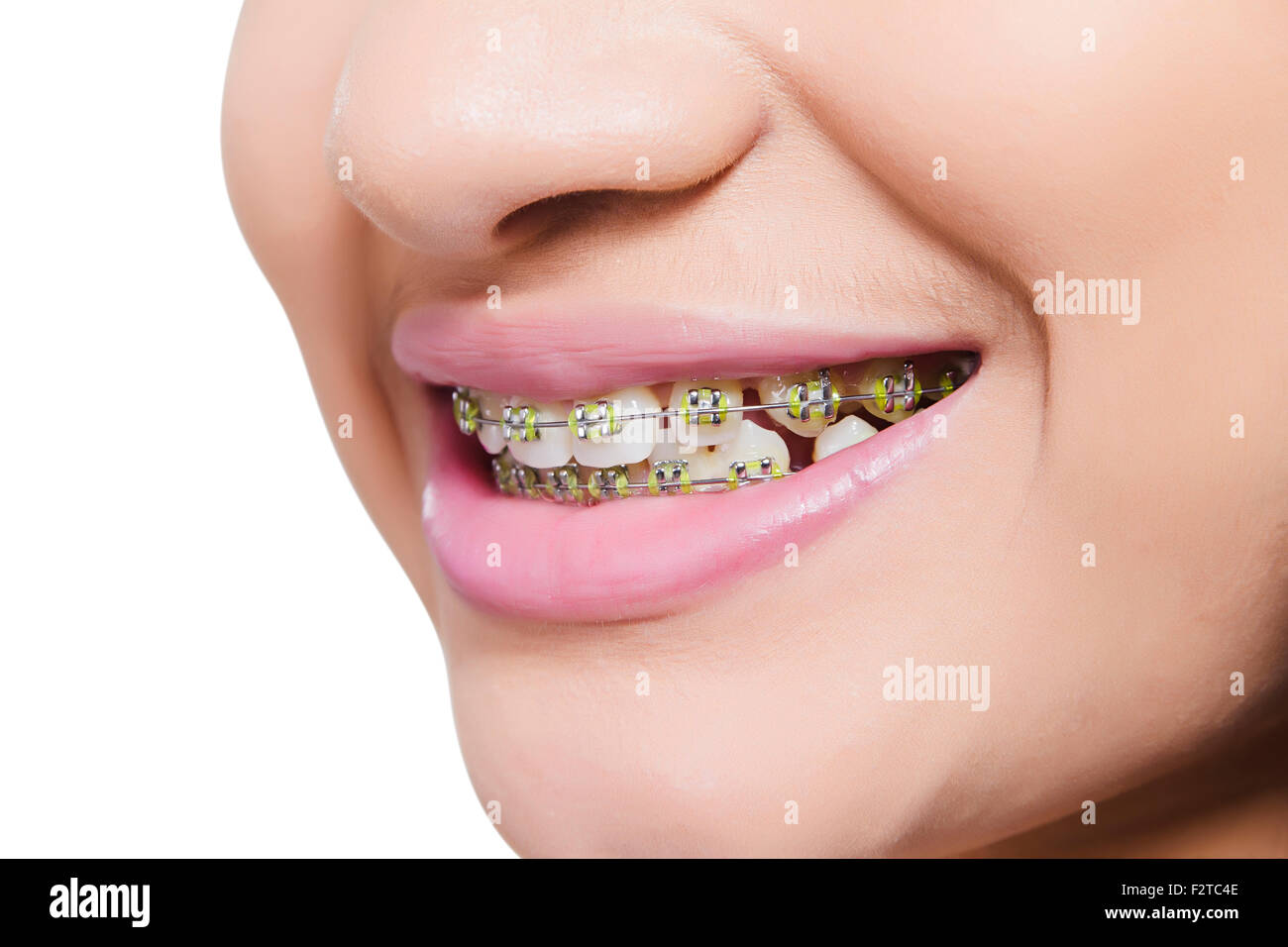 1 indian Teenager Girl Teeth Showing Stock Photo