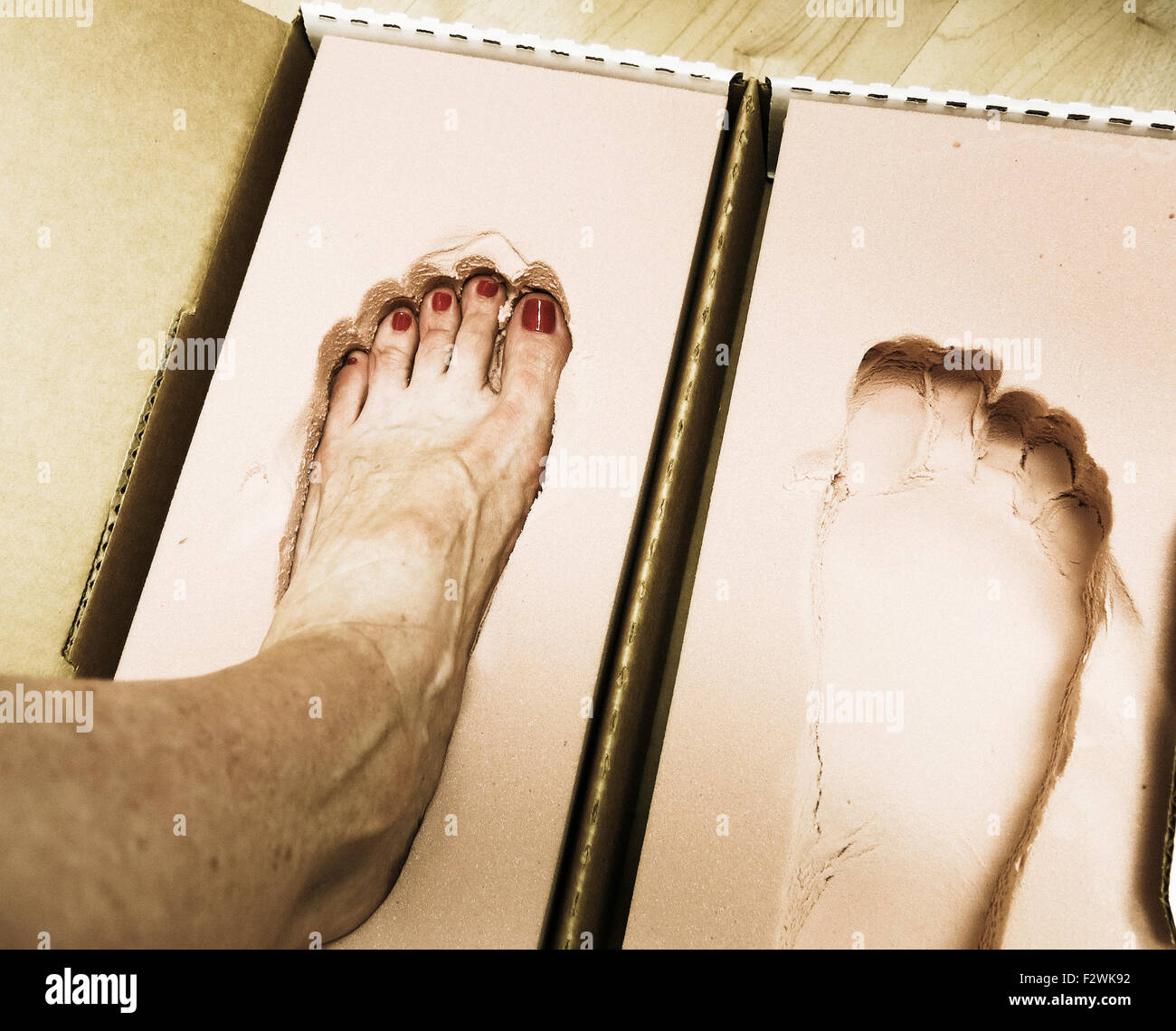 Orthotic Foot Mold Stock Photo Alamy