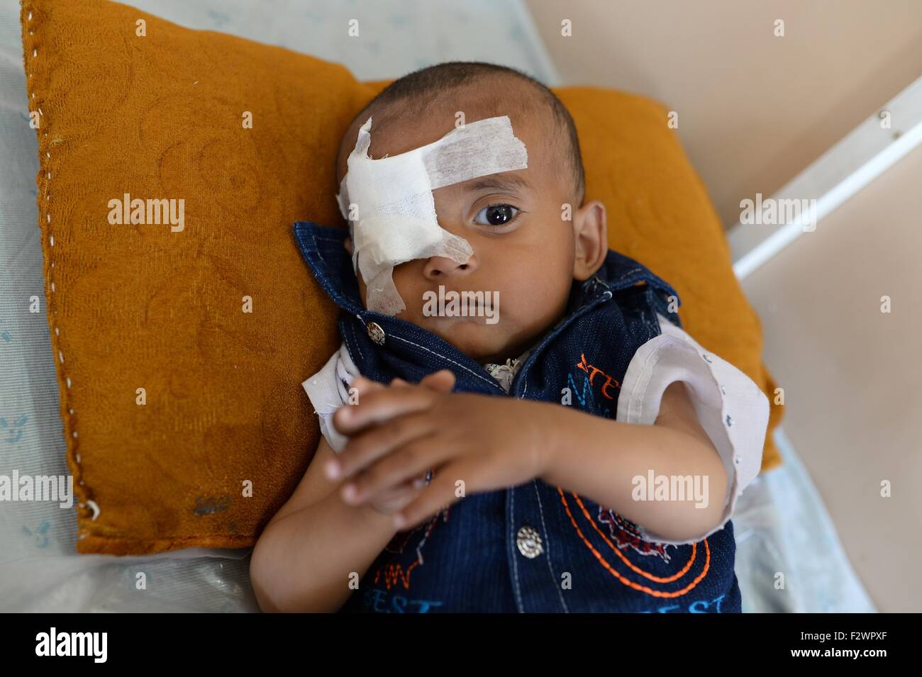 Kabul, Afghanistan. 06th Aug, 2015. The eleven-month-old son of farmer Ahmad Zai lies on a bed at the Mirwais hospital run by the Red Cross in Kabul, Afghanistan, 06 August 2015. A shrapnel had entered the brain of the boy through one of his eyes. Around 250,000 people received medical treatment at Mirwais hospital in 2014. Photo: Subel Bhandari/dpa/Alamy Live News Stock Photo
