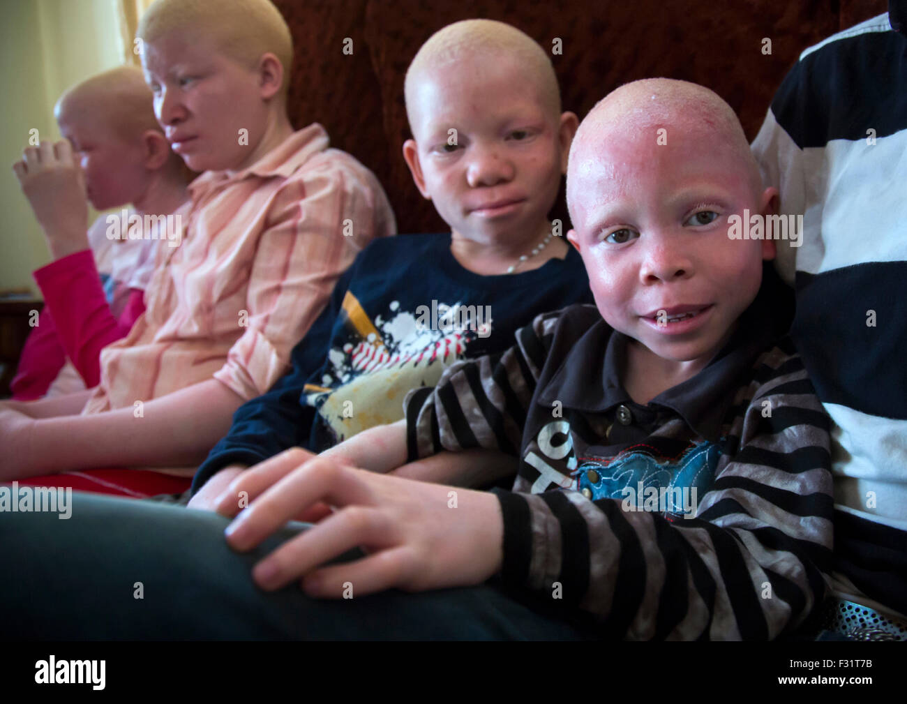 Tanzania, East Africa, Dar es Salaam, albinos teens and children with albinism at under the same sun house Stock Photo