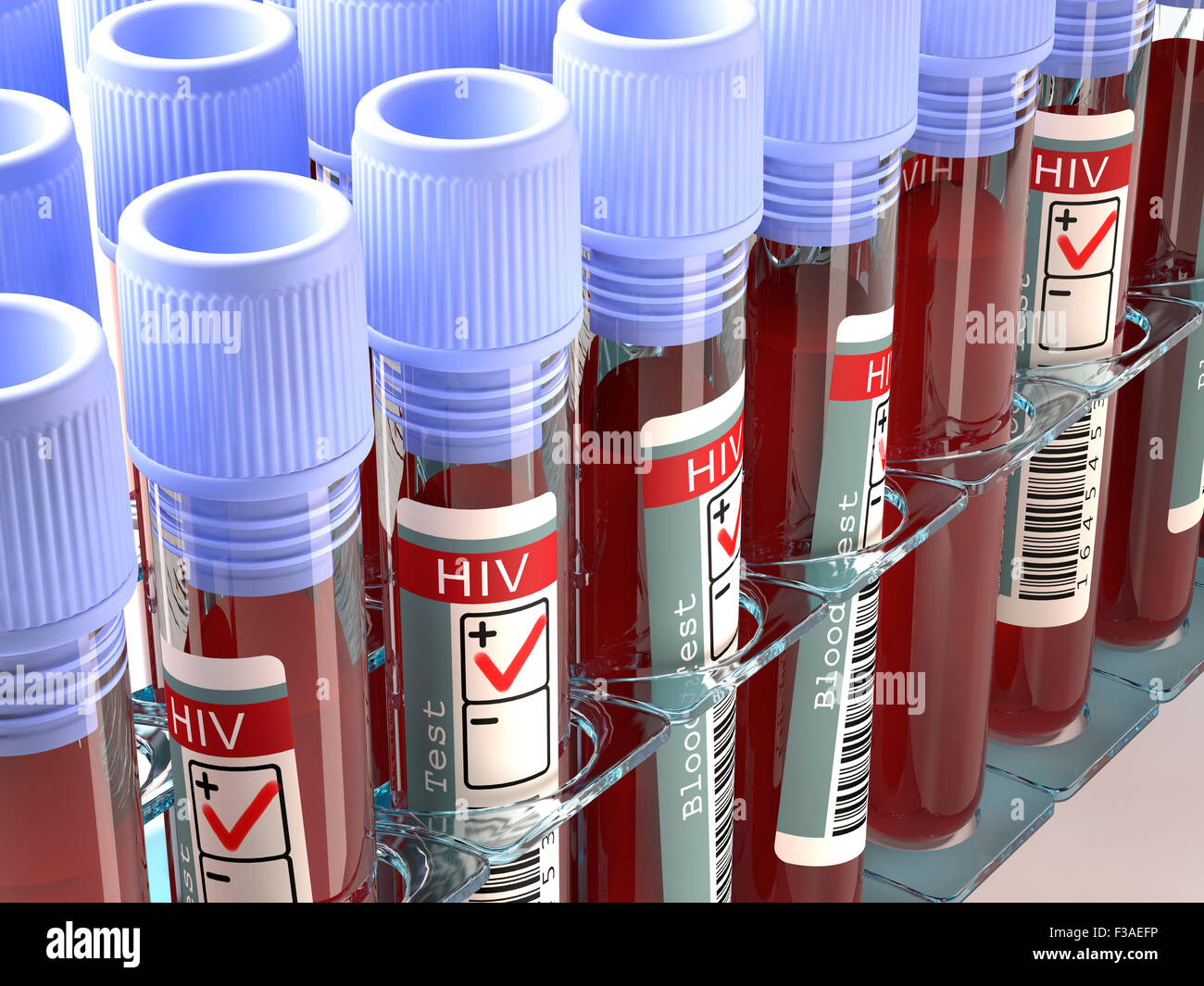 Positive hiv blood test hires stock photography and images Alamy