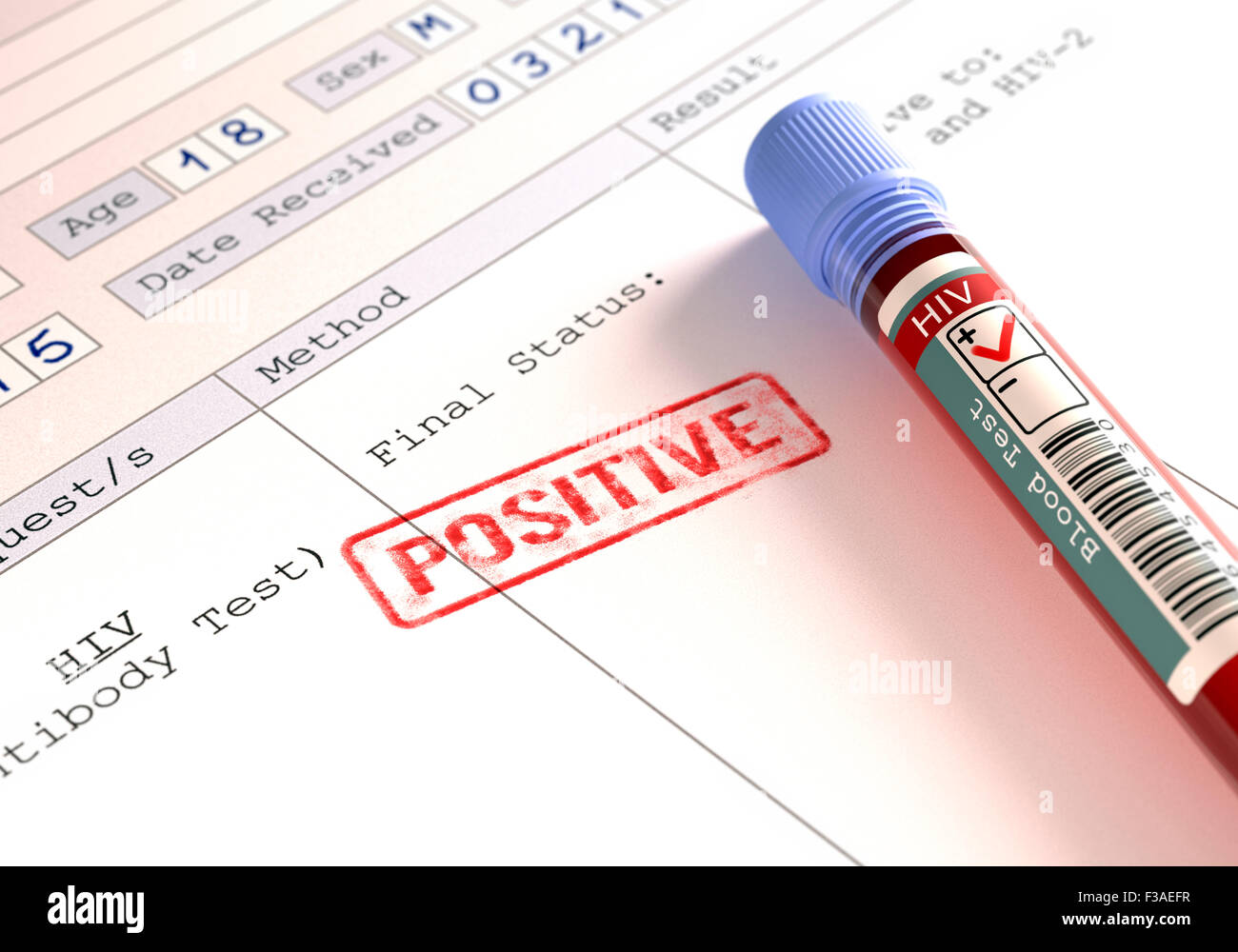 Positive HIV (human immunodeficiency virus) blood test results, computer illustration. Stock Photo