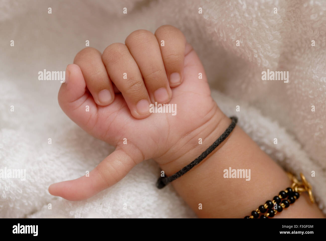 Baby born with six fingers birth defect hexadactyly -  MR#512 Stock Photo