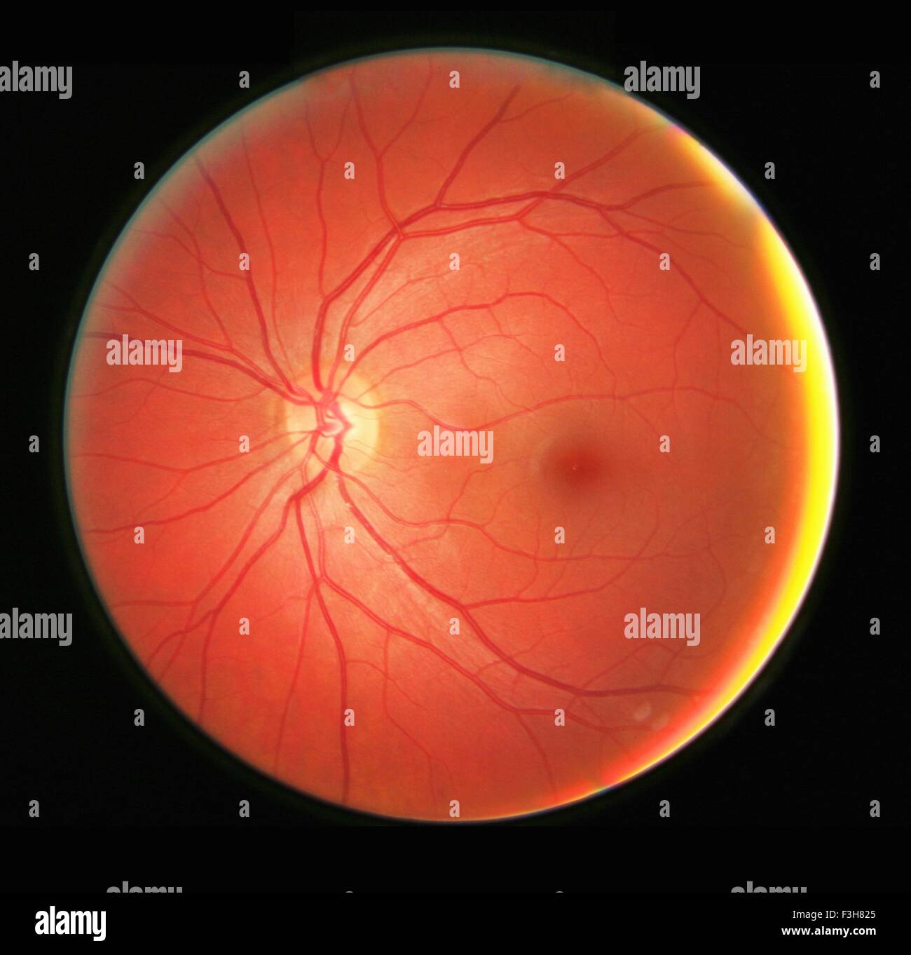 Fundus photograph of the left eye, showing the retina, macula, fovea and related structures Stock Photo
