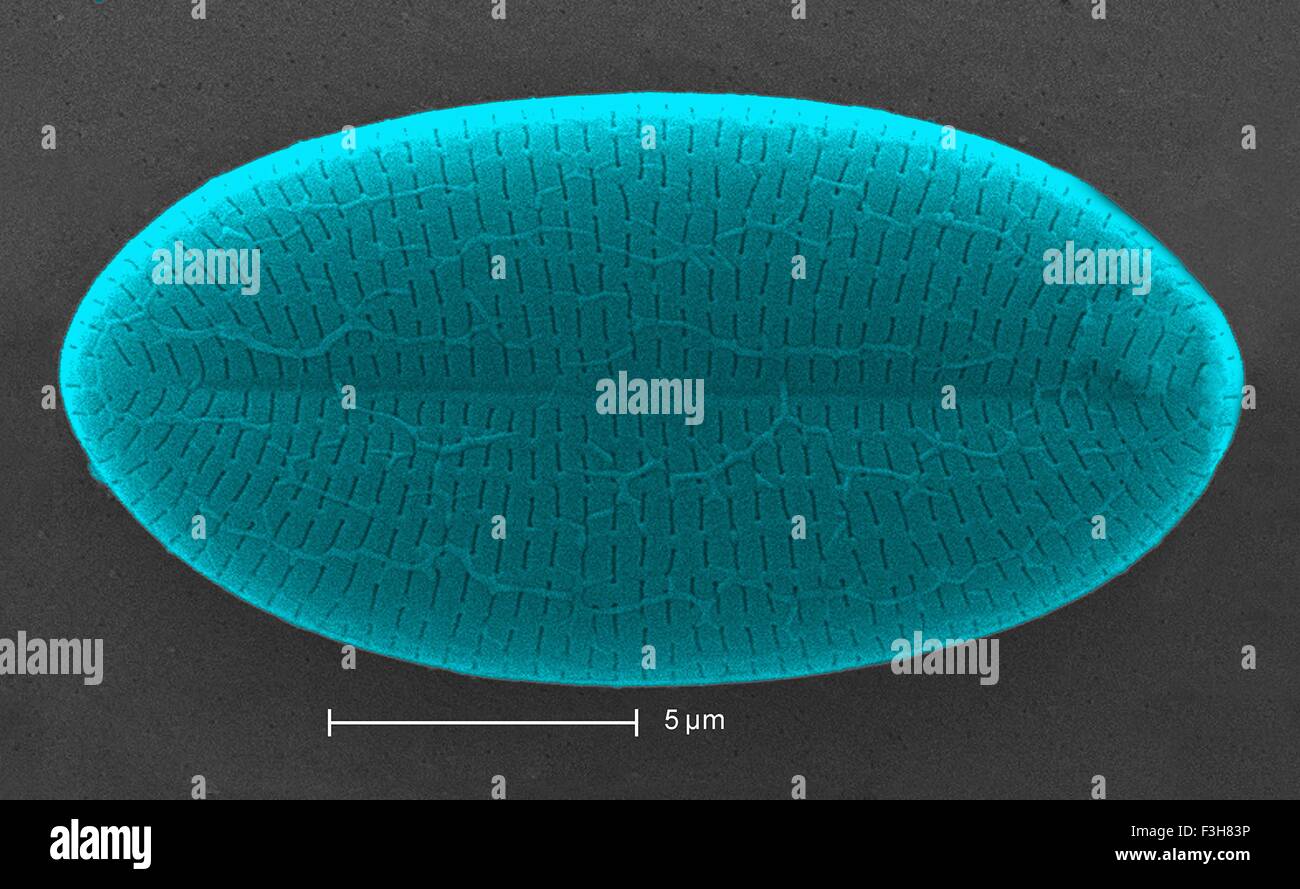 Scanning electron micrograph diatom Stock Photo