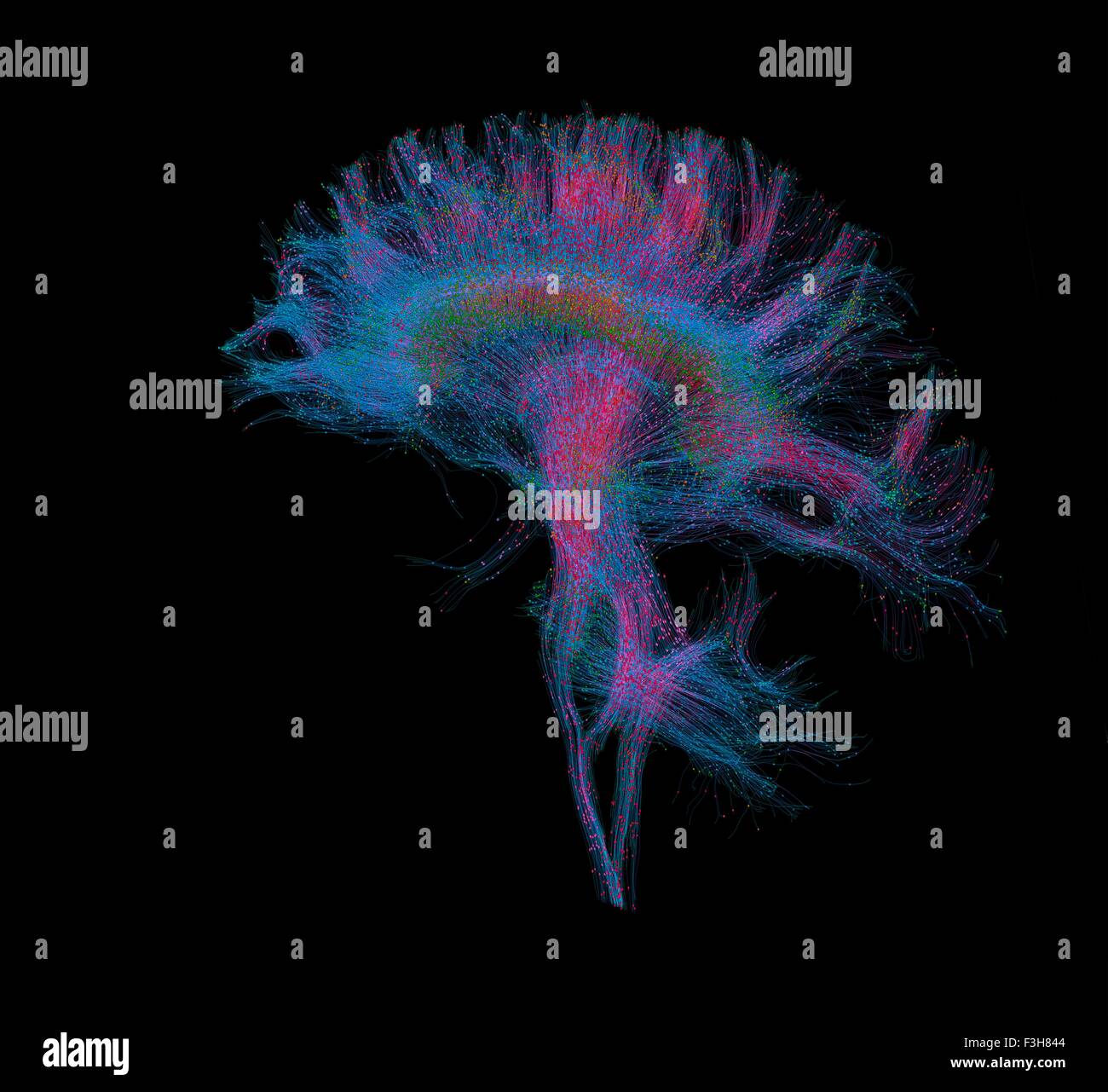 Diffusion MRI, also referred to as diffusion tensor imaging or DTI, of the human brain Stock Photo