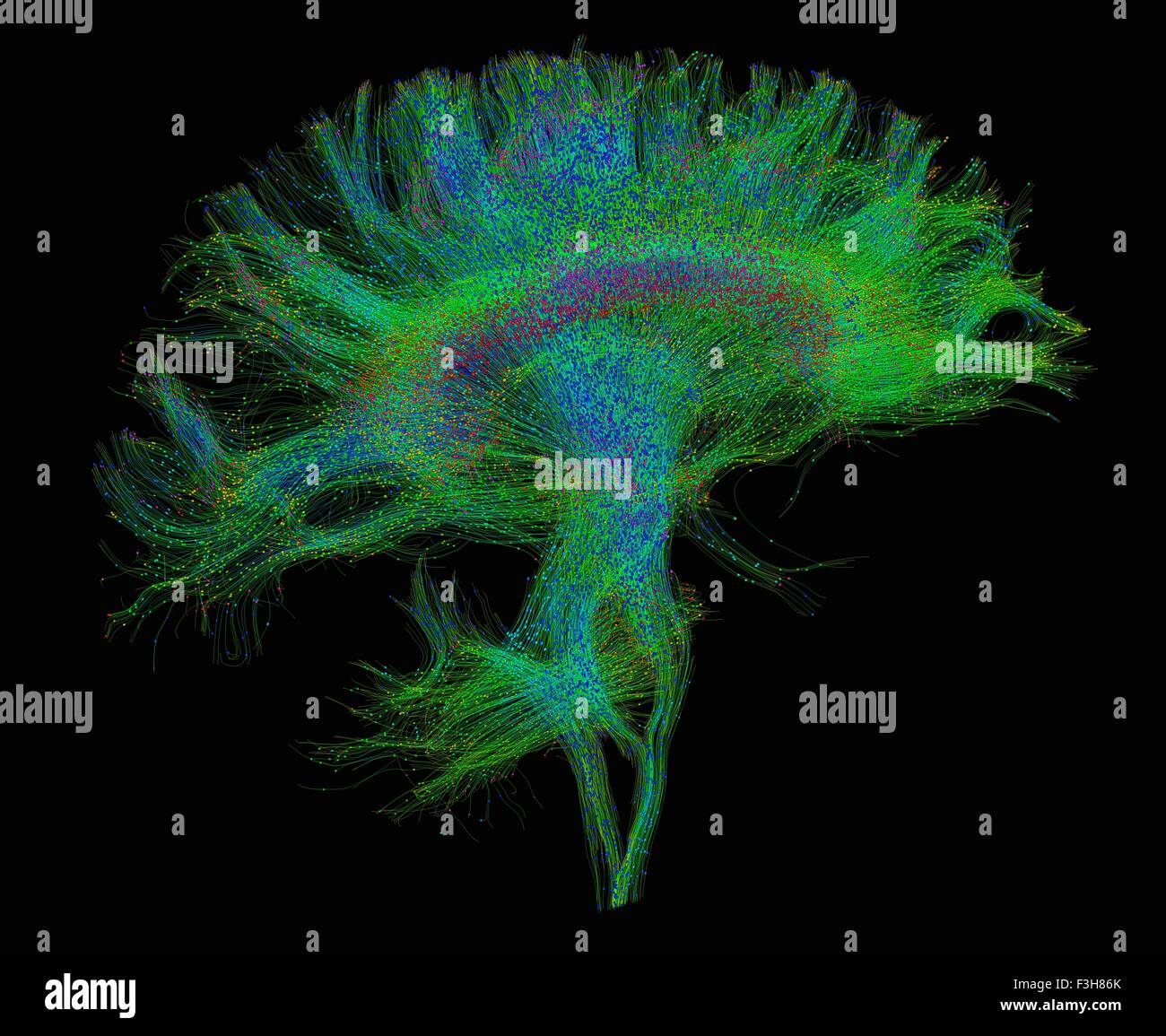 Diffusion MRI, also referred to as diffusion tensor imaging or DTI, of the human brain Stock Photo