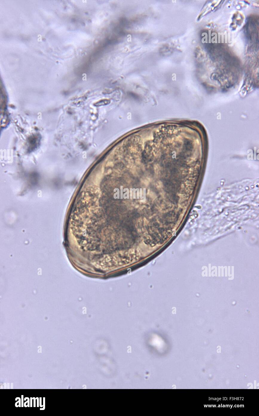 Micrograph of Paragonimus westermani termatode egg Stock Photo