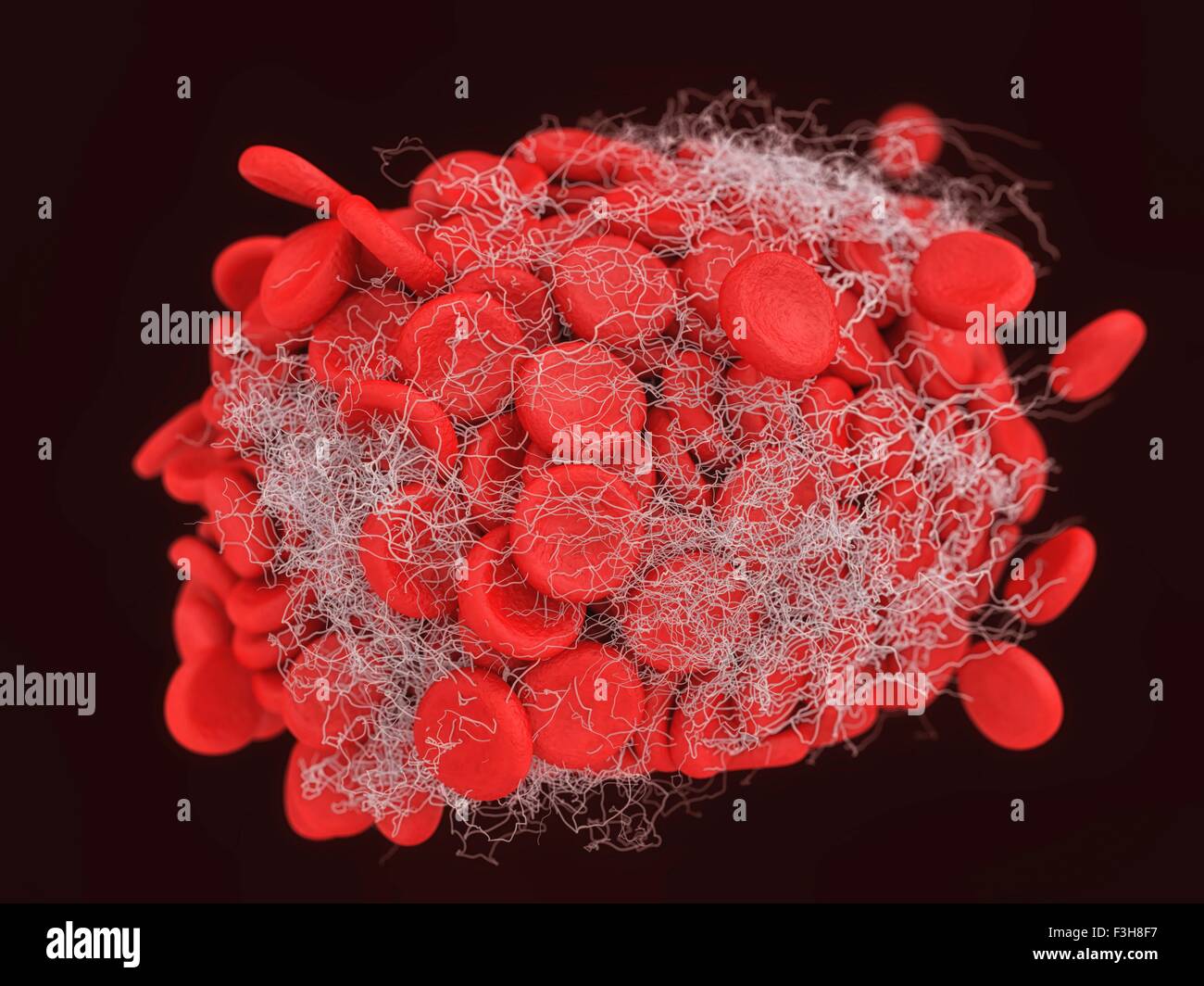 Illustration of a blood clot showing a clump of red blood cells intertwined in a fibrin mesh Stock Photo