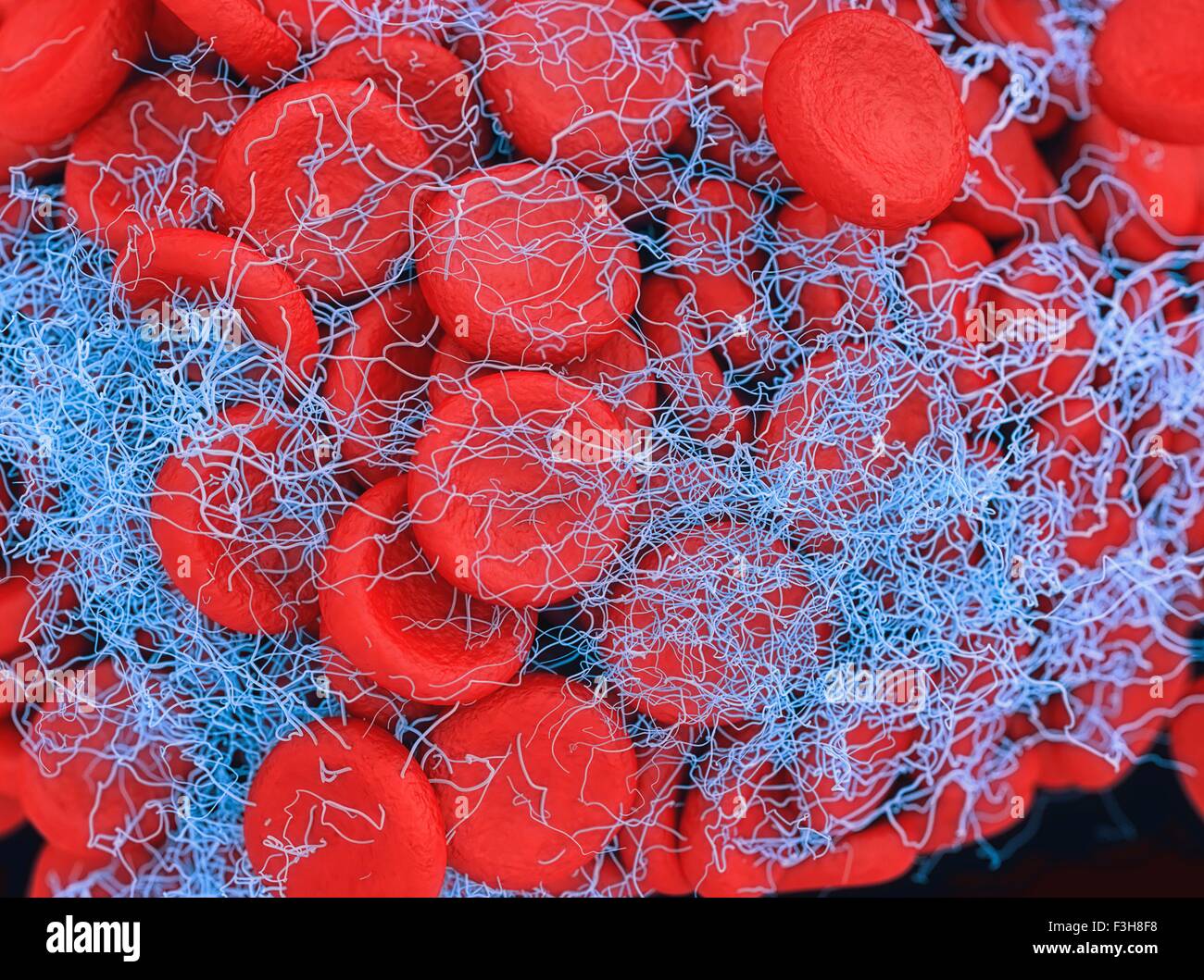 Illustration of a blood clot showing a clump of red blood cells intertwined in a fibrin mesh Stock Photo