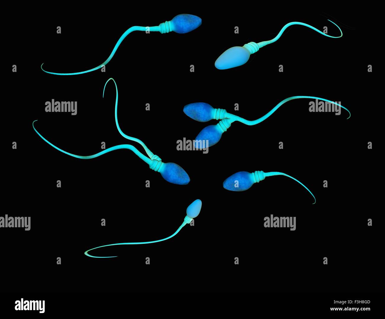 Illustration of abnormalities and deformities of human sperm cells Stock Photo