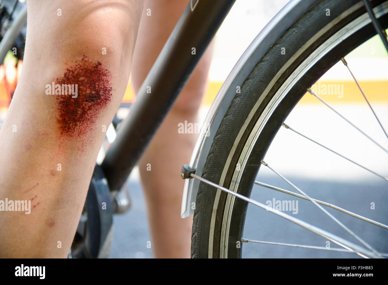 Cropped view of bicycle and girls leg with grazed knee Stock Photo