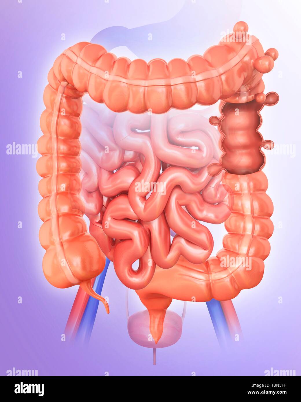 Large intestine diverticulitis hires stock photography and images Alamy