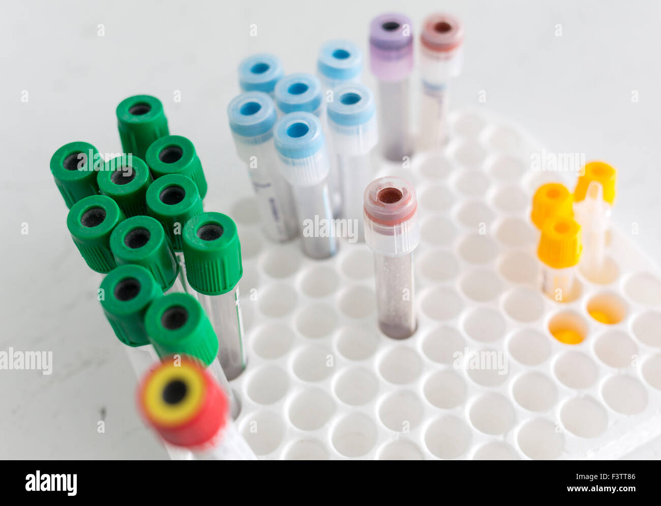 A rack of different vacuum venipuncture test tubes in a hospital Stock Photo Alamy