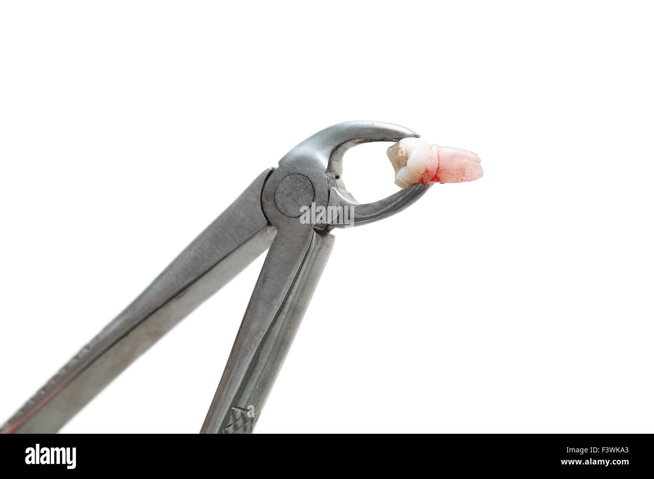 forceps with extracted tooth isolated Stock Photo Alamy