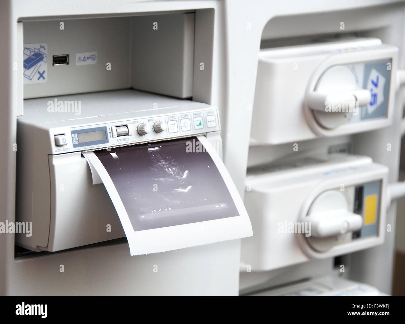 3d ultrasound hi-res stock photography and images - Alamy