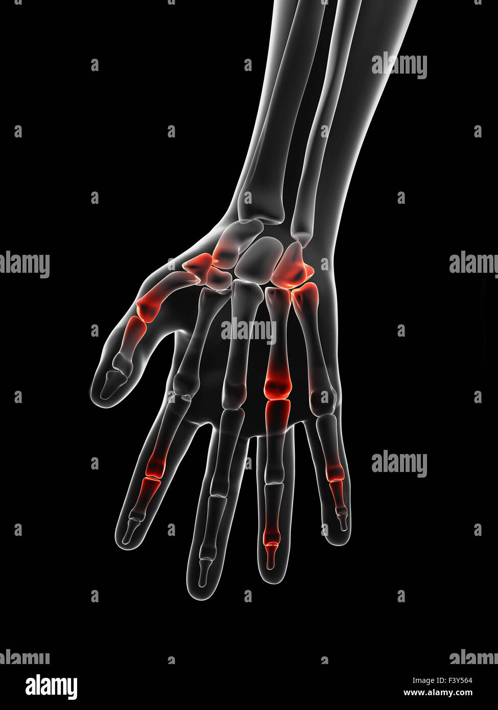painful finger joints Stock Photo Alamy