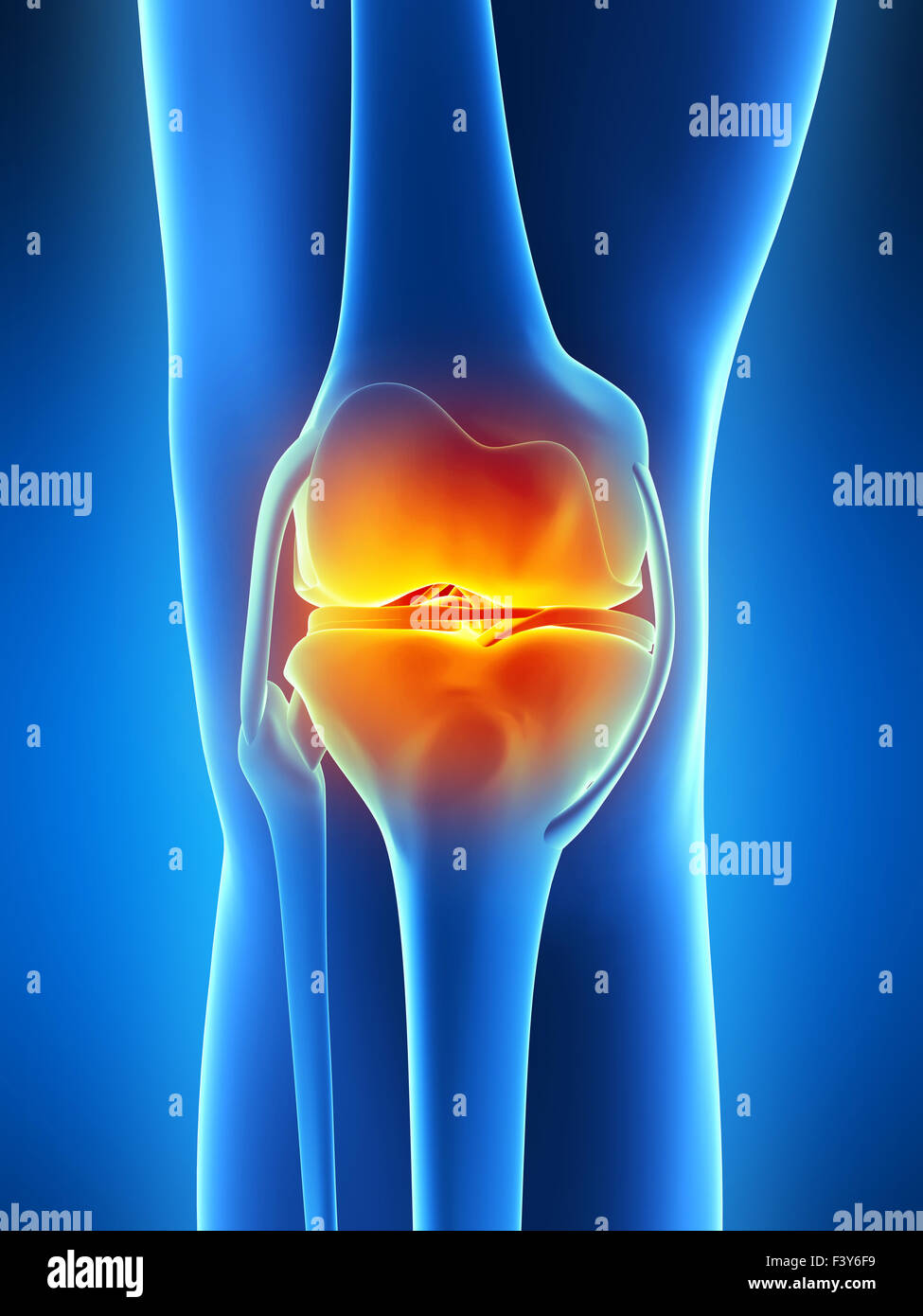 Foot bone stress hi res stock photography and images Alamy